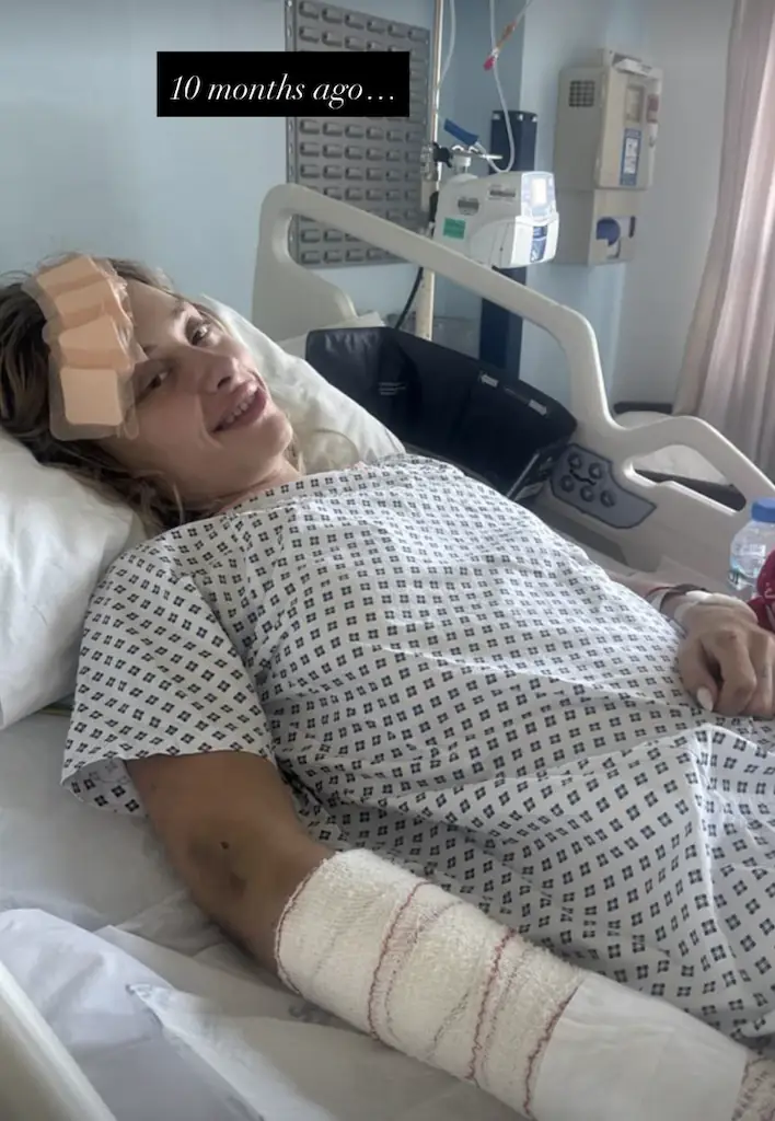 The model has shared her recovery journey with fans. Credit: Instagram/@mariia.kovalchuuk