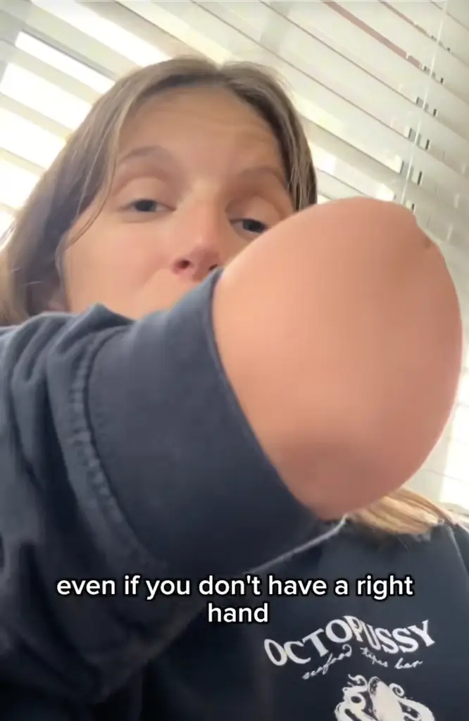 Katie's arm stops above the elbow. Credit: TikTok / @slightlyoff.balance
