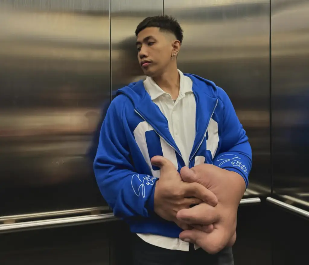 Mark Davidson Jacildo has a rare condition than makes his hands massive. Credit: Mark Davidson Jacildo/Instagram