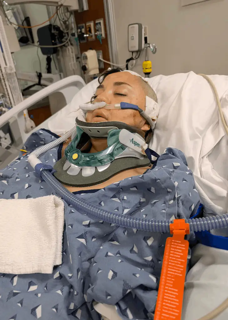 Pamela Guillen was unconscious for weeks as a result of her brain injury. Credit: Pamela Guillen 