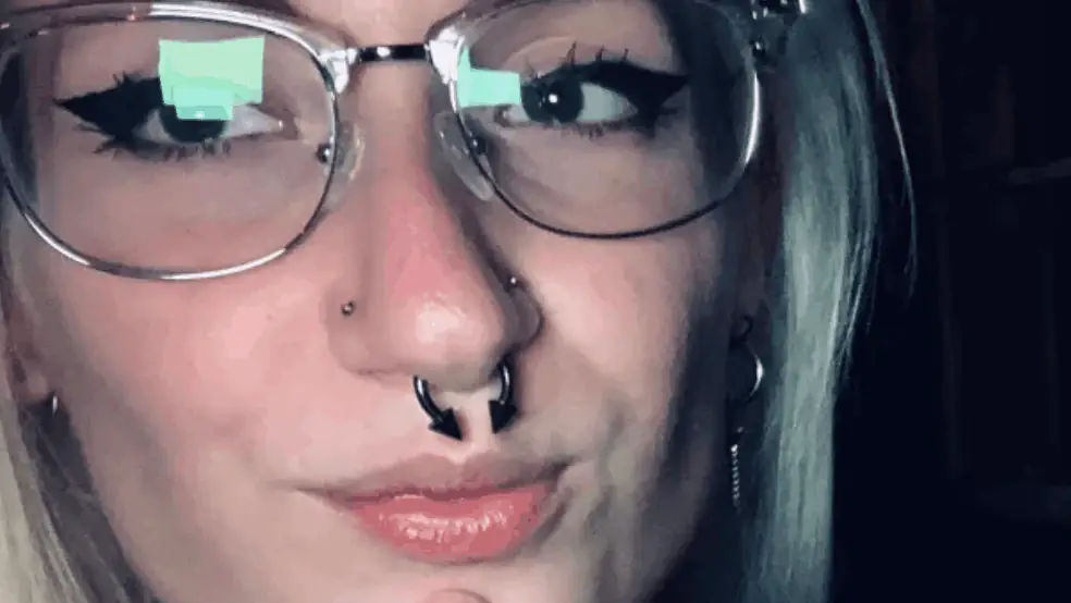 Naomi Greer-Wilkinson has been in a coma for more than a month. Credit: Joshua Wilkinson