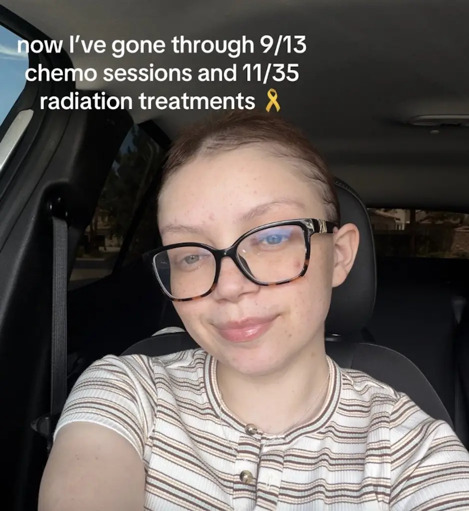 Burkins is currently having treatment after being diagnosed with cancer. Credit: TikTok/Aida Burkins