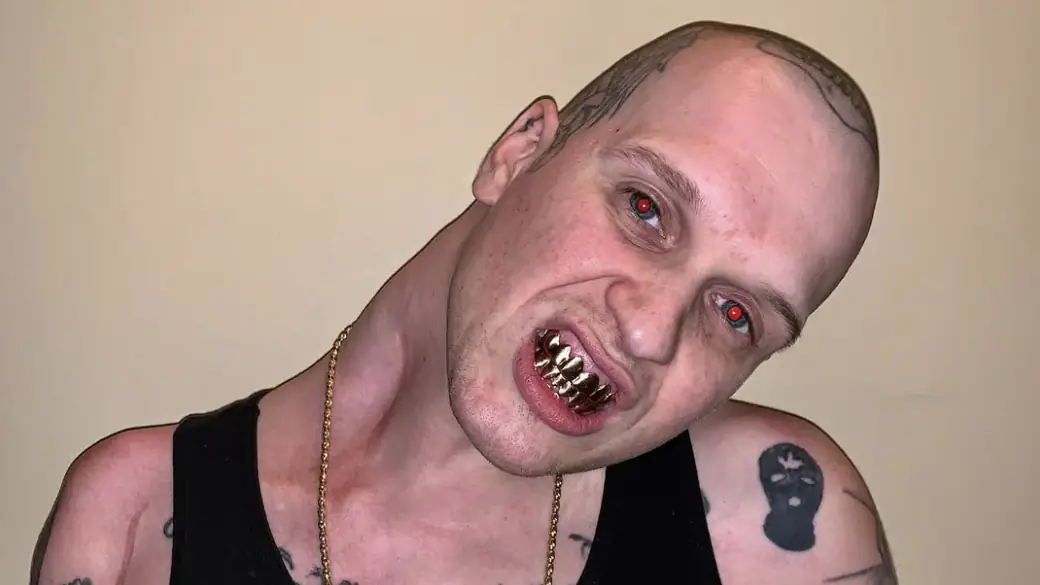 Horrifying reason 'Sideneck' got his nickname as he shares unrecognizable before-and-after photos