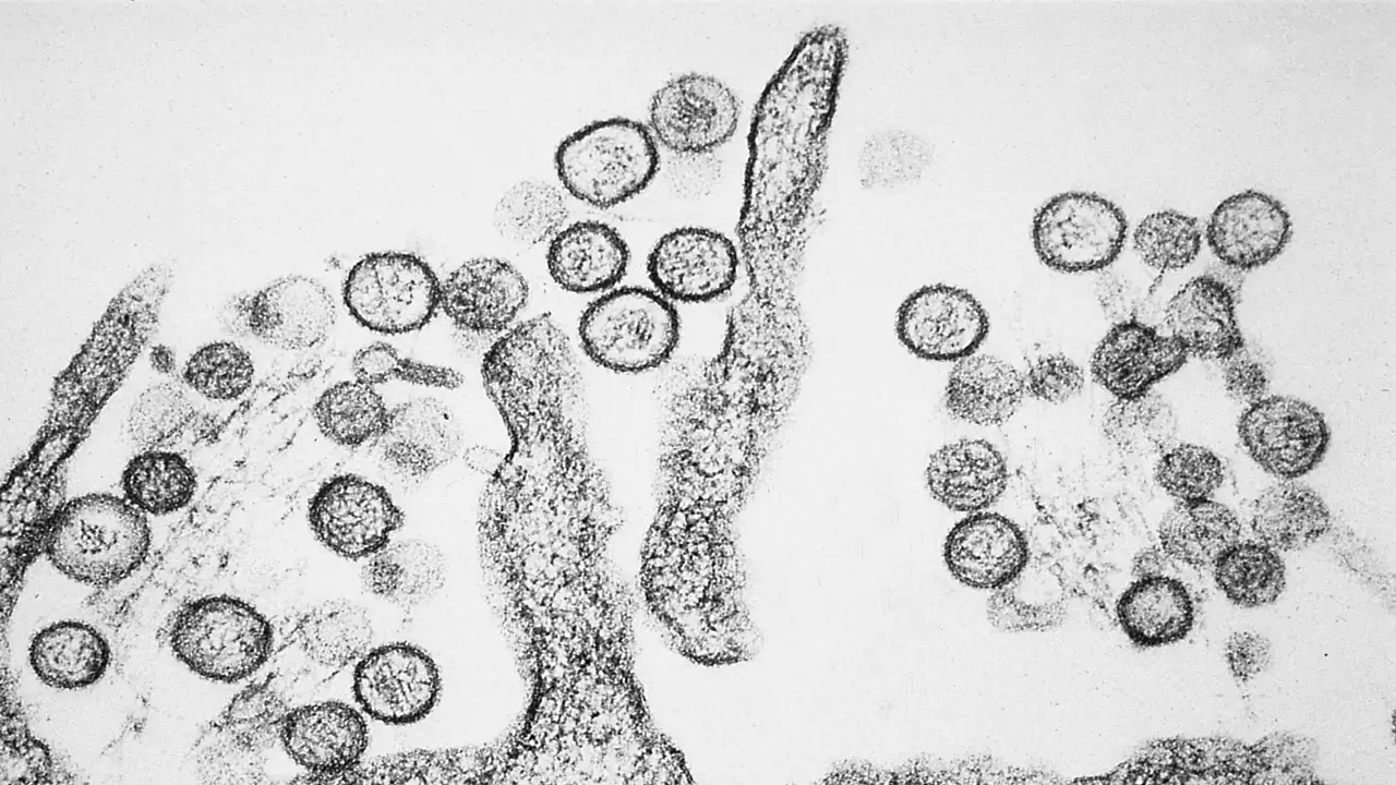 Hantavirus is a very serious illness. Credit: Wikimedia Commons