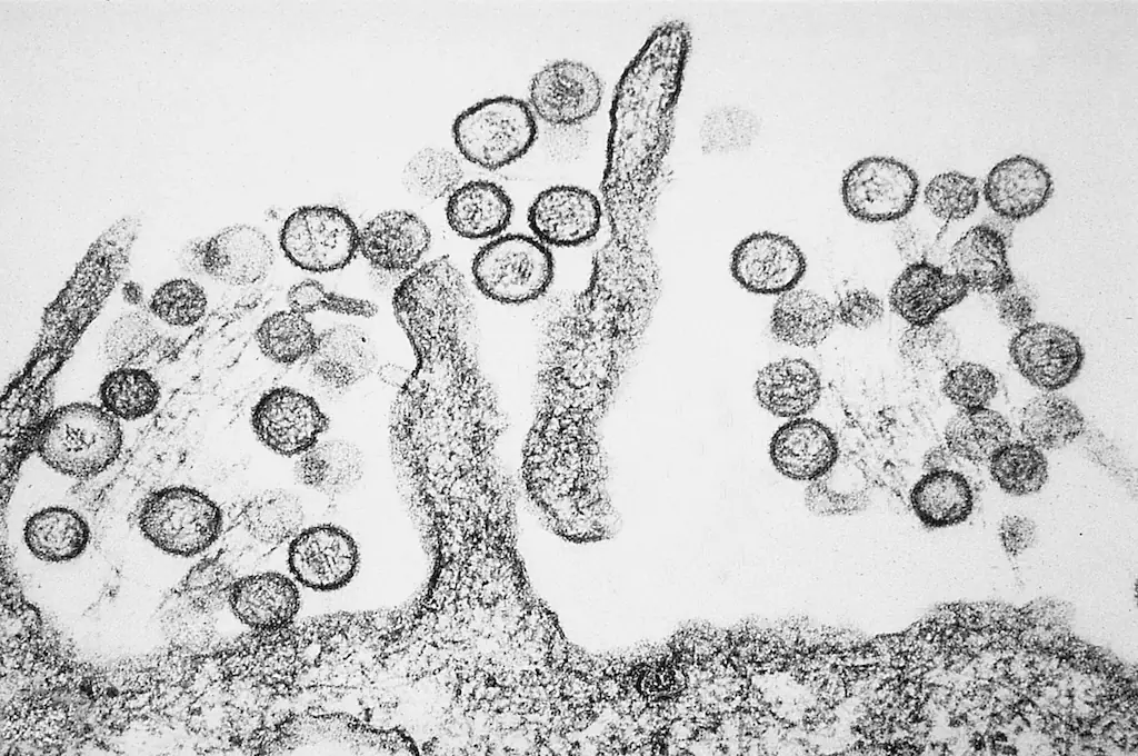 Hantavirus is most commonly spread via rodent waste. Credit: Wikimedia Commons