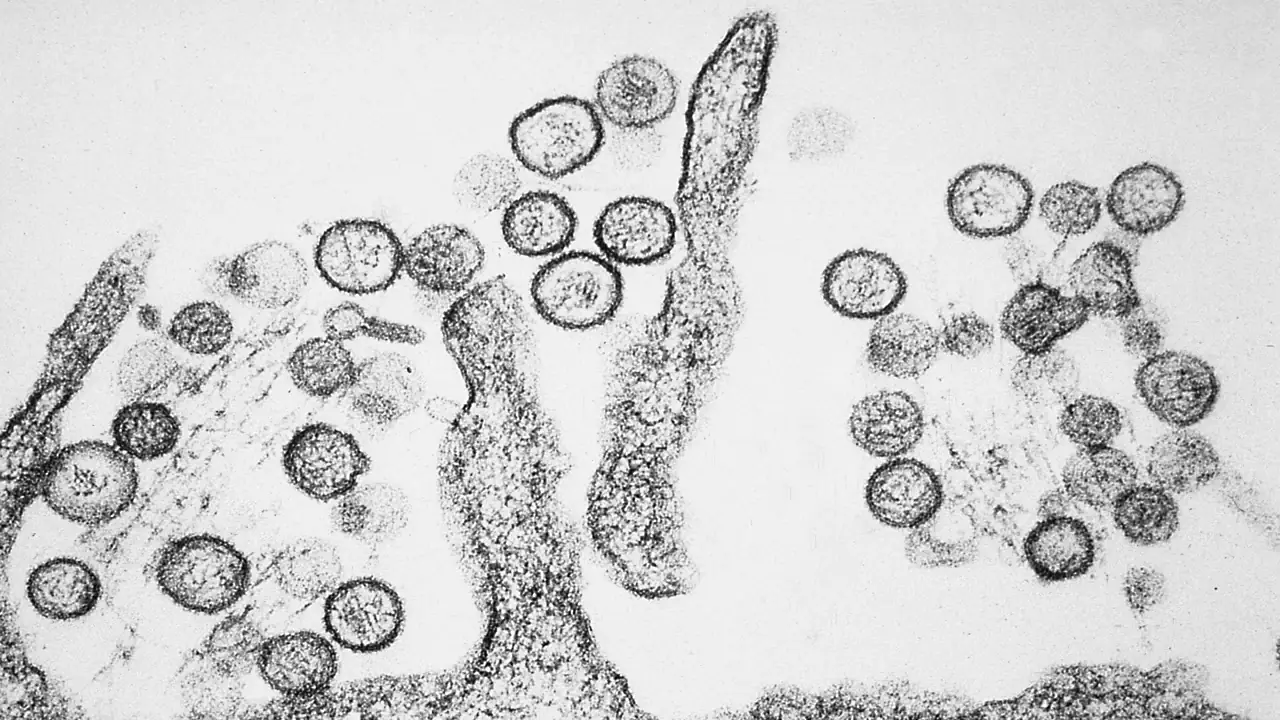 Hantavirus is a very serious illness. Credit: Wikimedia Commons