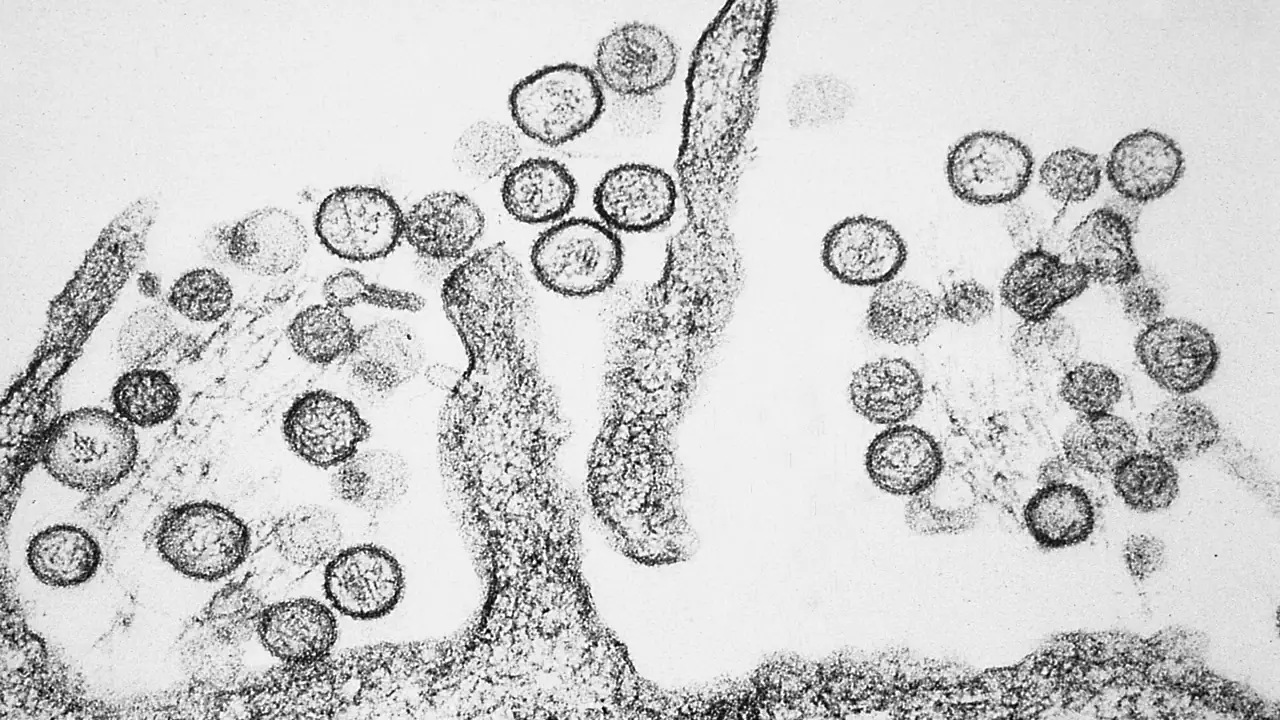 Hantavirus is a very serious illness. Credit: Wikimedia Commons
