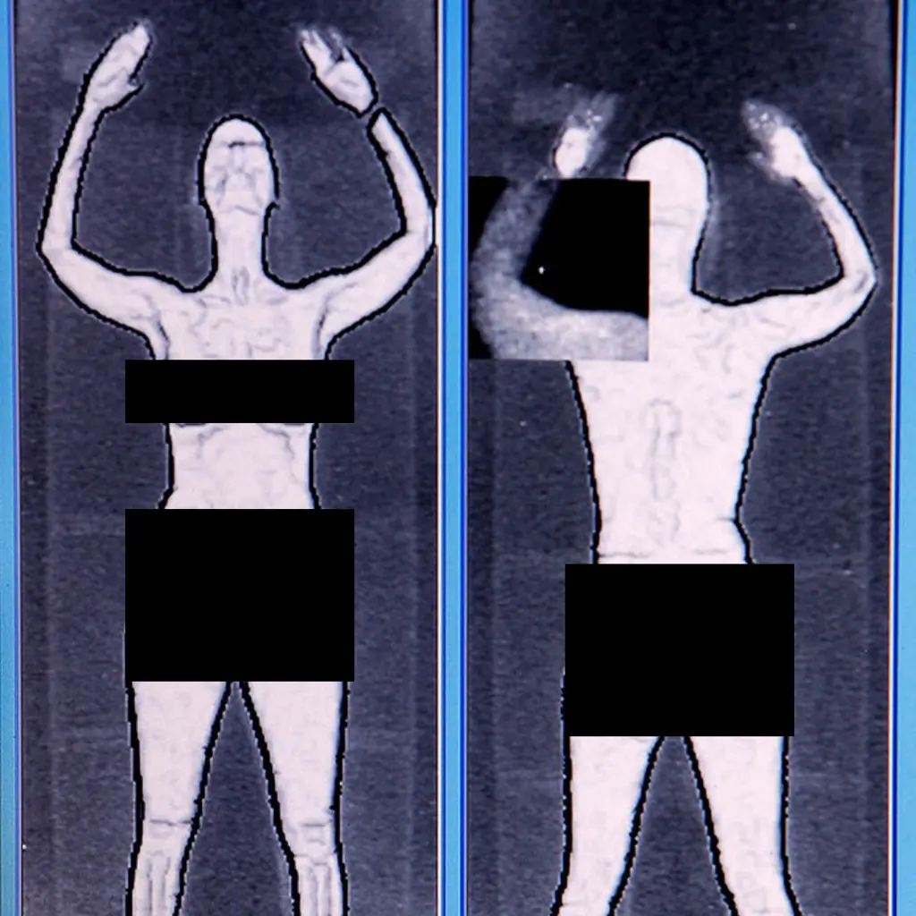 The TSA scanners caused backlash. Credit: Chip Somodevilla / Getty