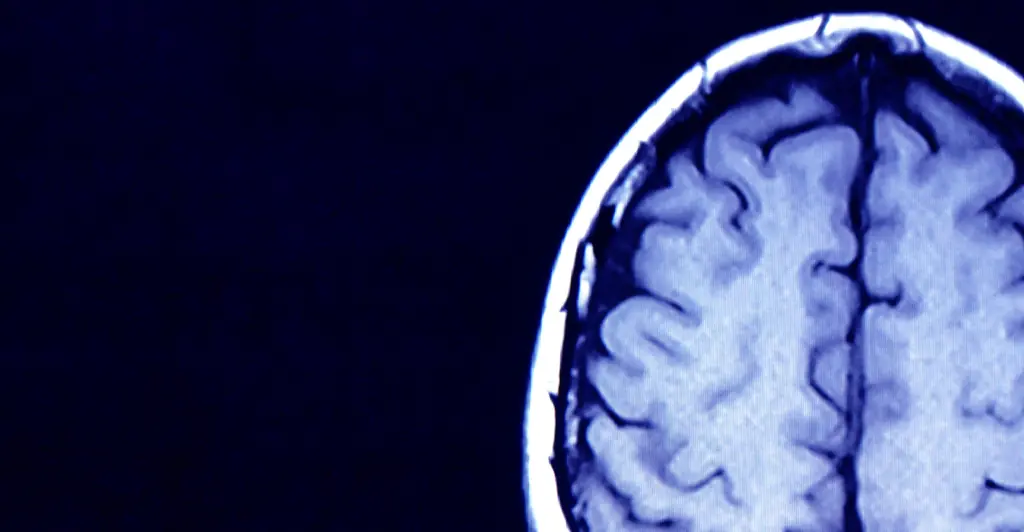 People are stunned after watching simulation of what happens to your brain when you die