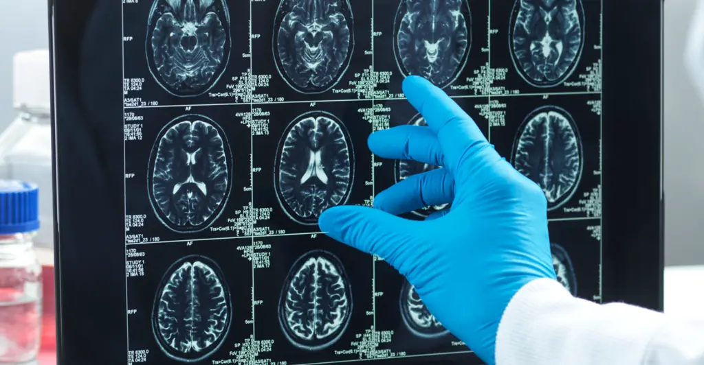 Man diagnosed with dementia aged 49 shares subtle change at work that made him realize something was wrong