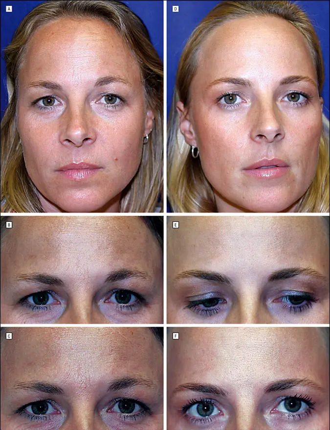 Credit: American Society for Dermatologic Surgery