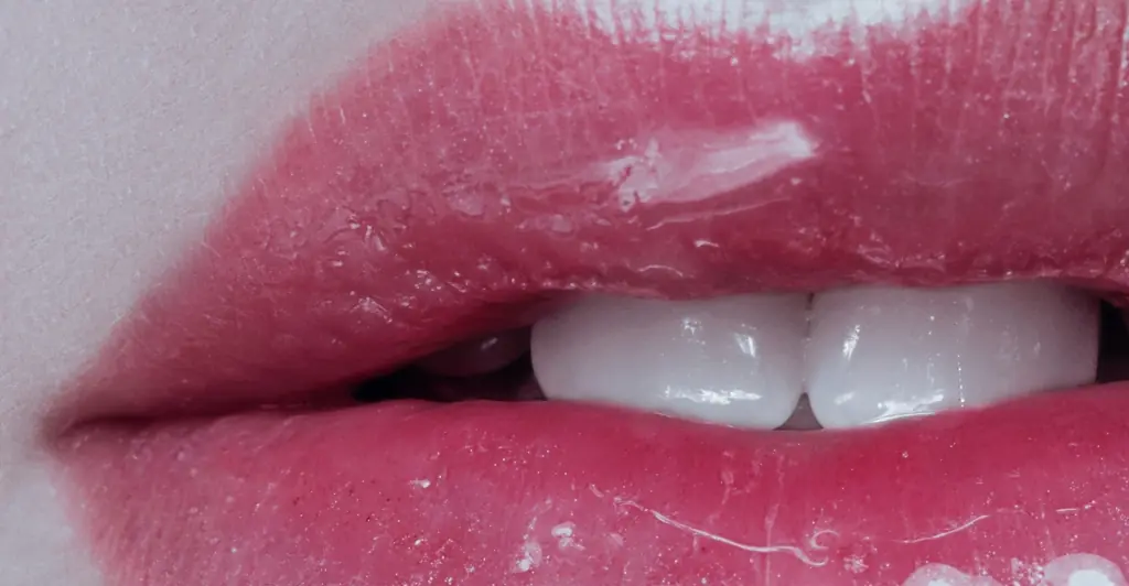 Woman with the 'world's biggest lips' shares photo of herself before life-threatening filler