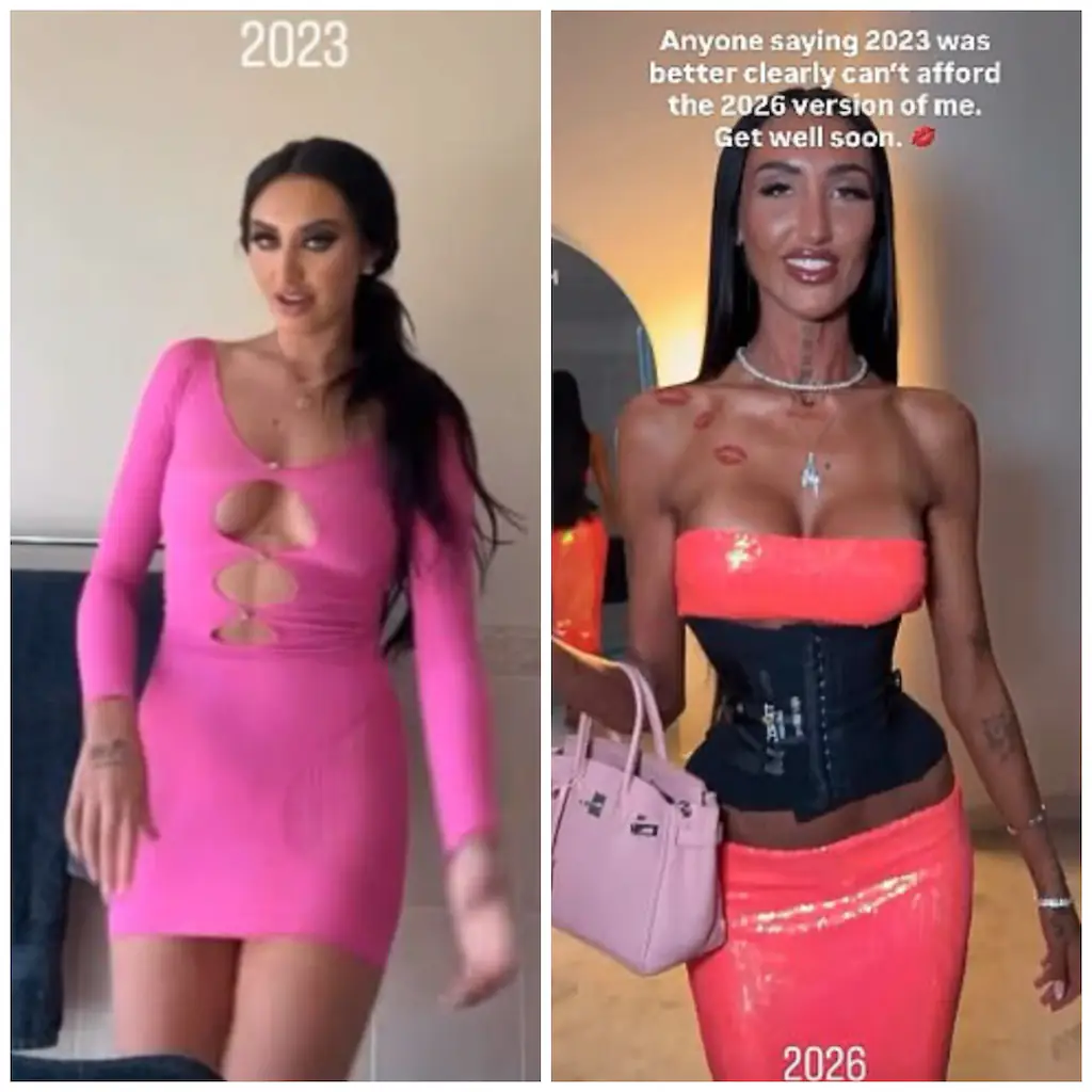 The Australian model shared her body transformation online in separate posts. Credit: Matilda Baxter/Instagram