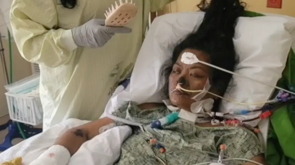 Now, the mom of two is a quadruple amputee. Credit: GoFundMe