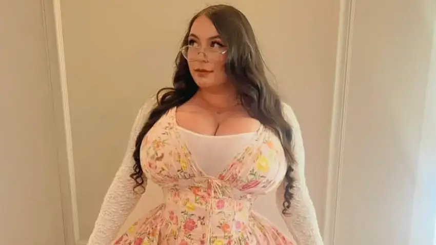 She's been treated very badly by some for her condition. Credit: Instagram/scotchdolly97