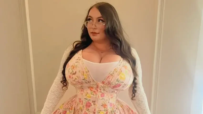 She's been treated very badly by some for her condition. Credit: Instagram/scotchdolly97