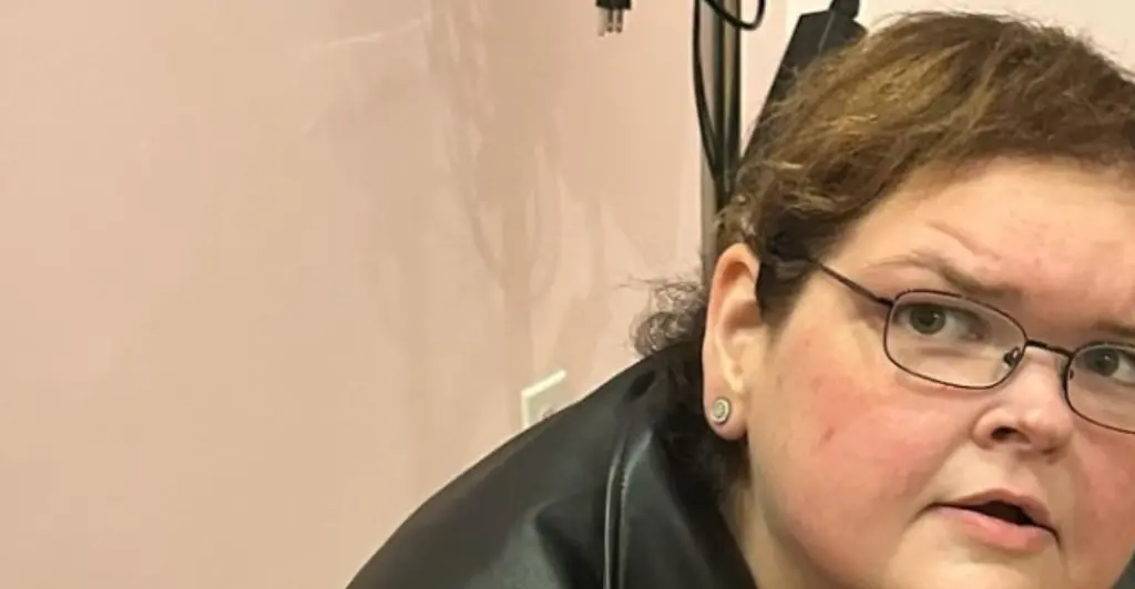 1000-lb Sisters star Tammy Slaton has undergone a huge transformation after skin removal surgery