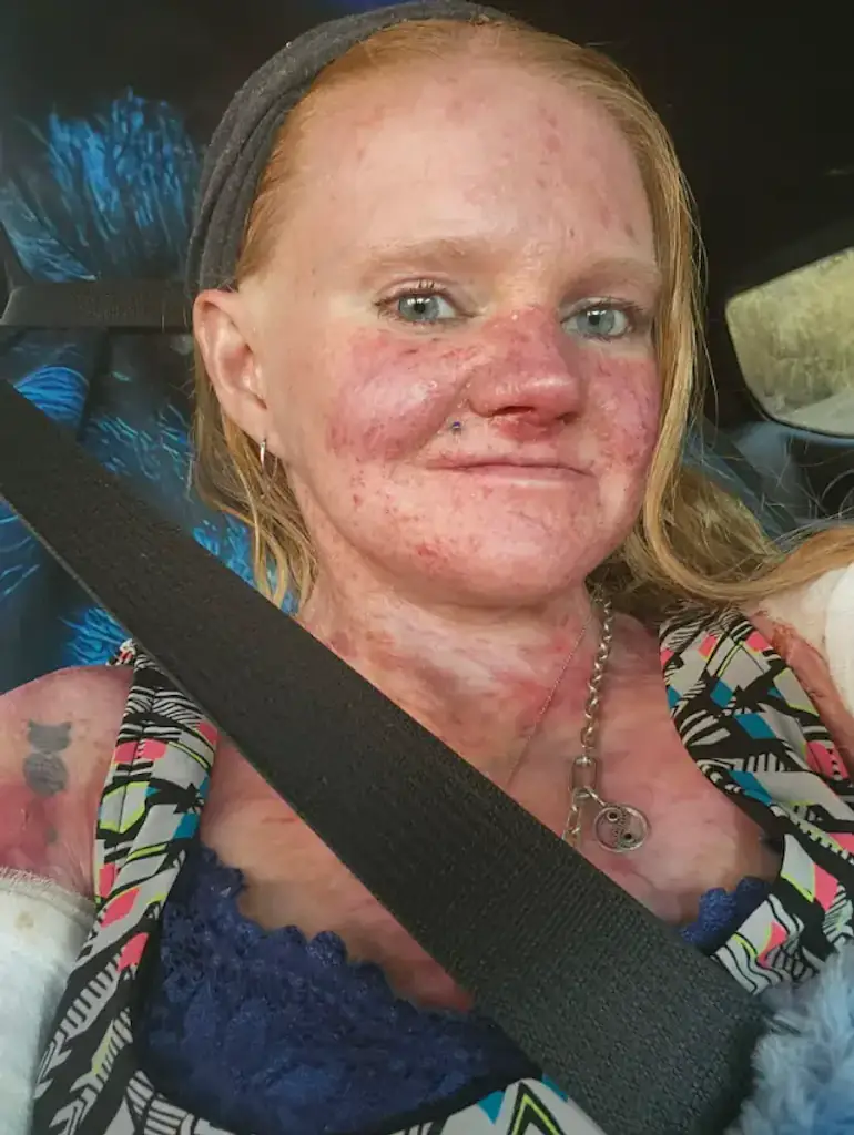 Just 500,000 people worldwide are thought to suffer with the condition (Picture: GoFundMe)