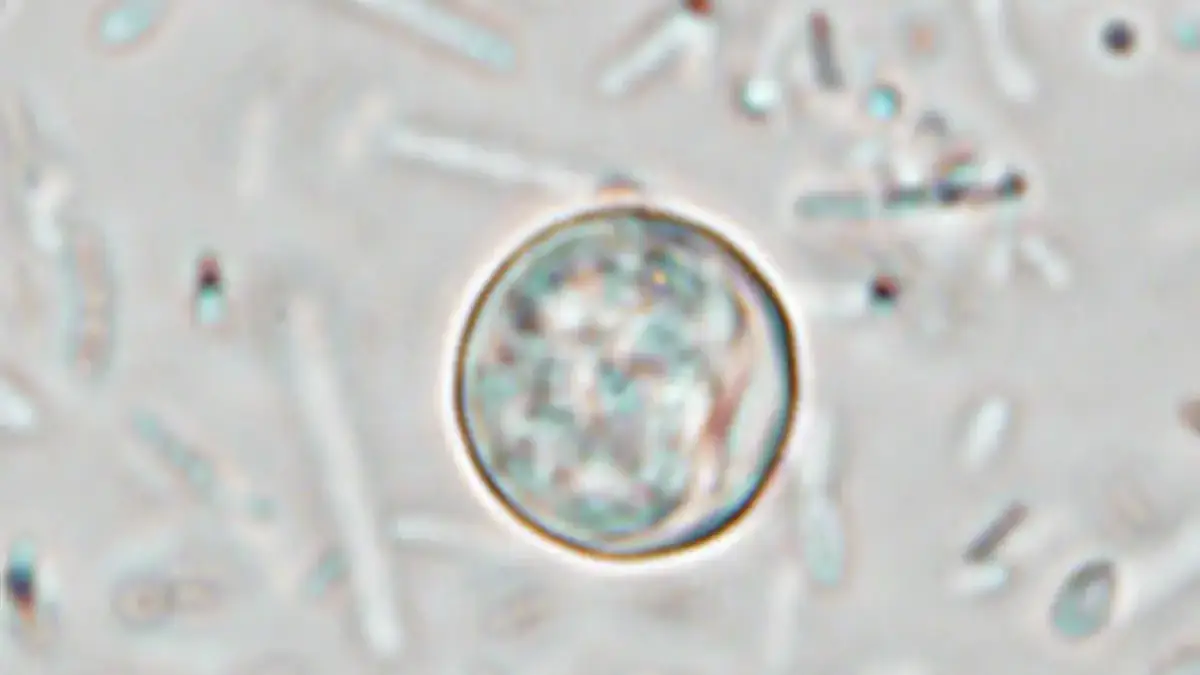 parasite Cyclospora cayetanensis