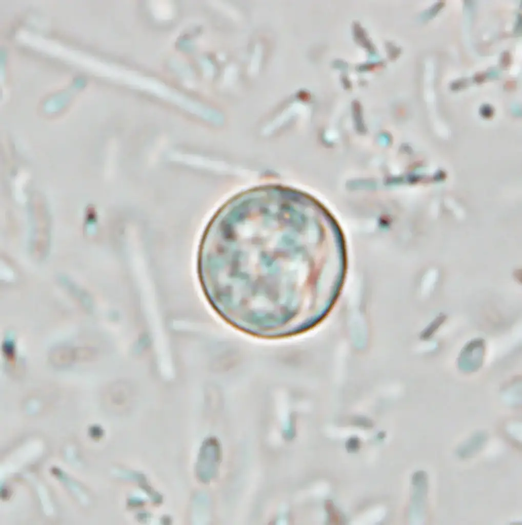 Cyclospora cayetanensis causes explosive, watery diarrhea. Credit: CDC