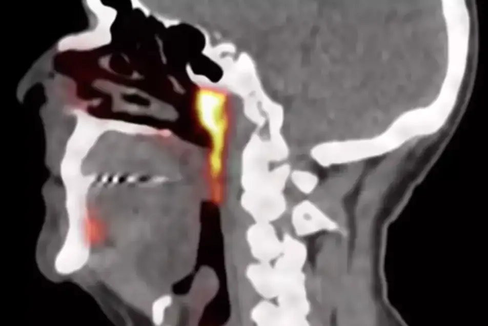 Credit: Antoni Van Leeuwenhoek / YouTube.