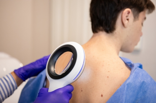 Doctor shares disturbing video of most severe skin cancer he's encountered and issues urgent health warning
