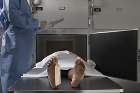 People are freaked out after mortician reveals what really happens to your organs after you die