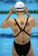 Real reason Olympic athletes have dark red cirlces on their backs