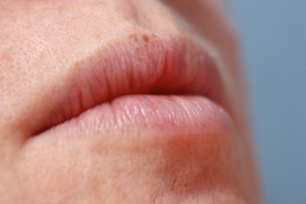 Reason why people get little white bumps on their lips and privates