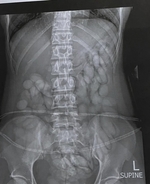 Passenger detained and arrested immediately after being x-rayed by airport security