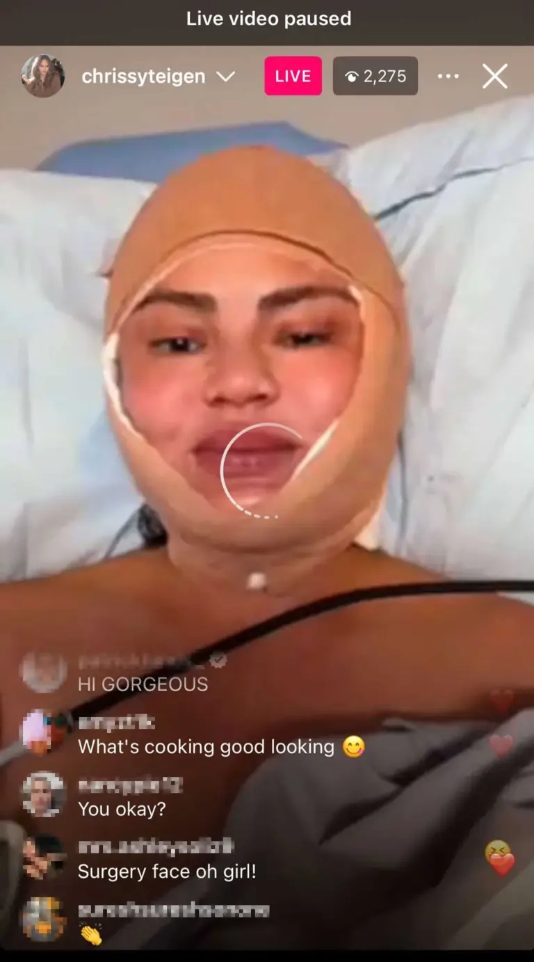 chrissy-teigen-sparks-plastic-surgery-105171819_994953.webp