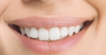 Woman who had all her teeth pulled out finally receives brand new beautiful smile