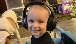 Babysitter arrested after allegedly hurting boy so badly he had to have part of his skull removed