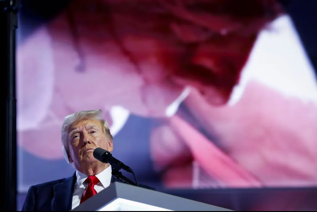 Trump shows a picture of his injuries from the rally. Credit: Anna Moneymaker/GettyCredit:
