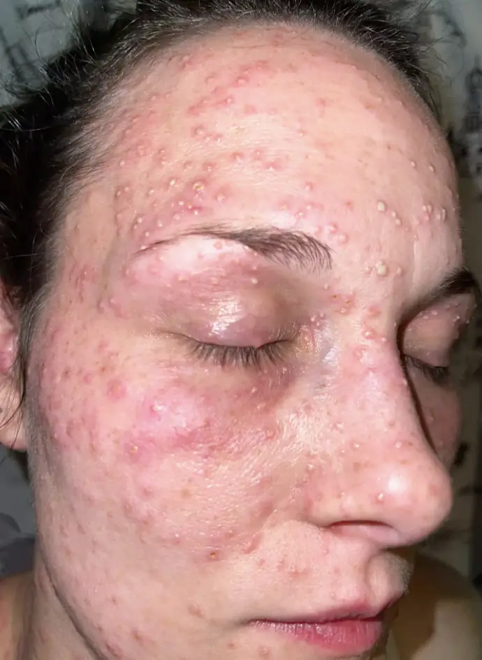 Credit: Kallinen PLLC