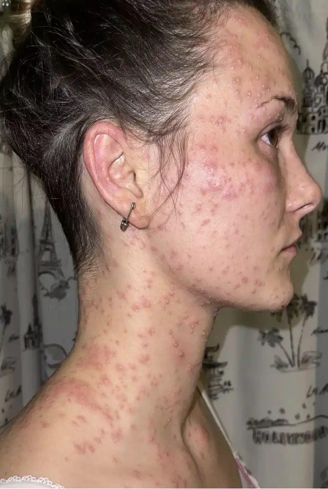 Credit: Kallinen PLLC