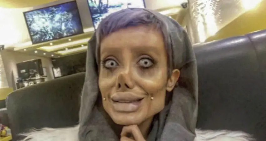 This woman underwent over 50 operations to look like Angelina Jolie