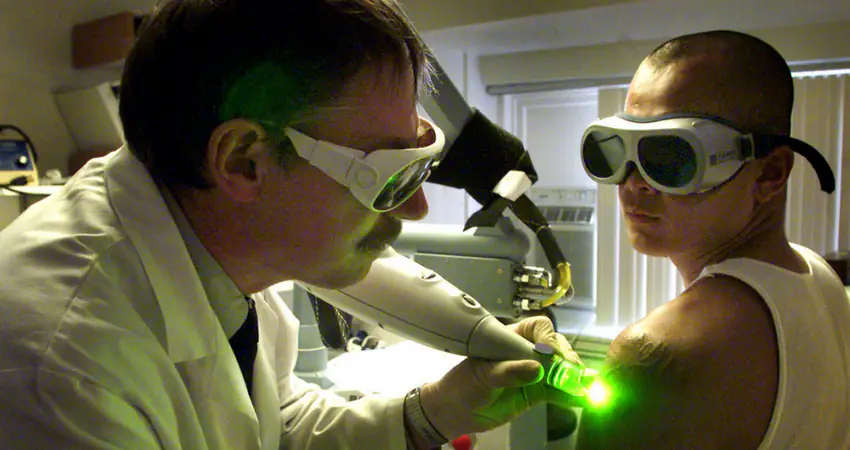 Man spends two years removing glasses tattooed on his face after bachelor party