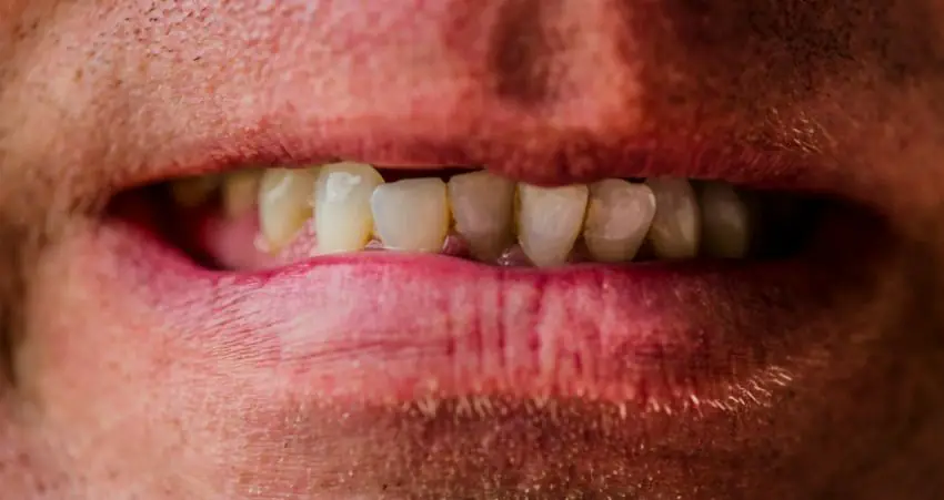 American woman refuses to date British men because they 'smoke, drink, and have bad teeth'