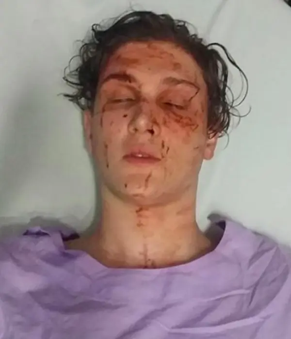 A semi conscious man. 