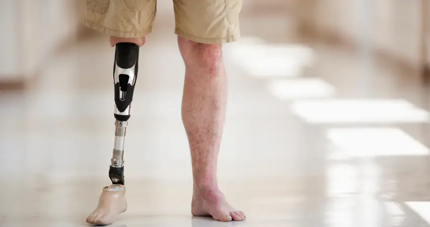 Amputee forced to crawl on anniversary vacation after airline confiscates scooter batteries