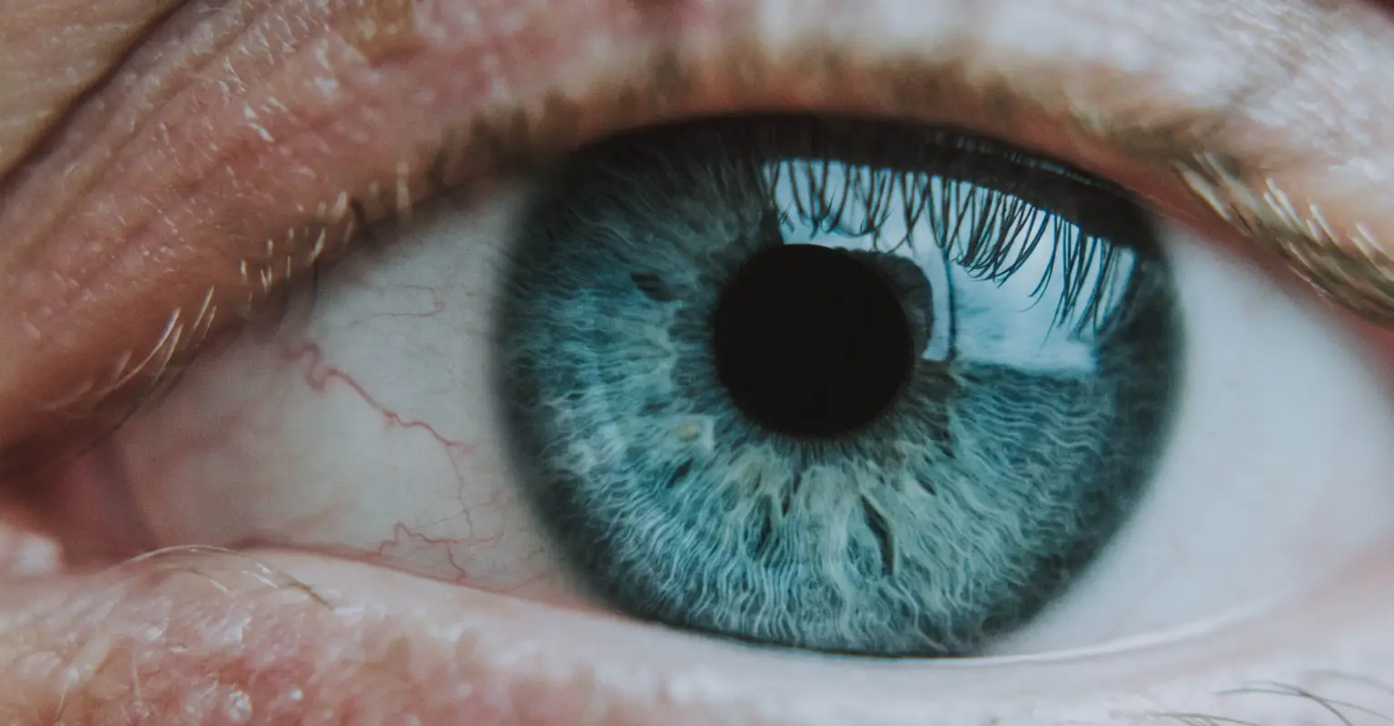 Mom urged to seek a doctor after sharing photo of daughter's eye