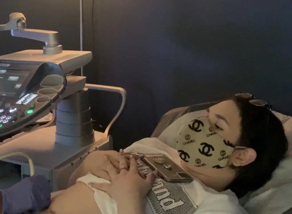 A woman having a baby scan.