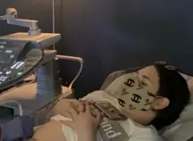 A woman having a baby scan.