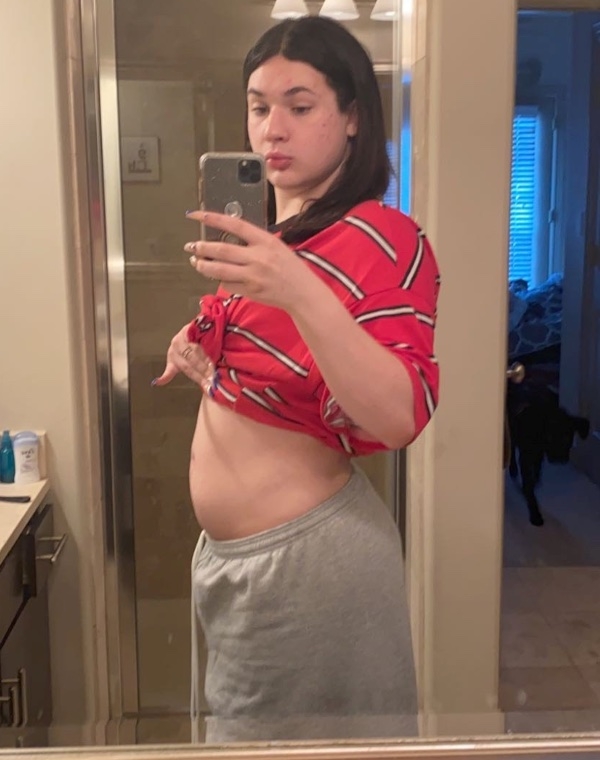 A pregnancy bump.