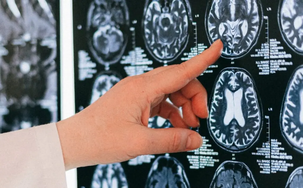 size-large wp-image-1263094953