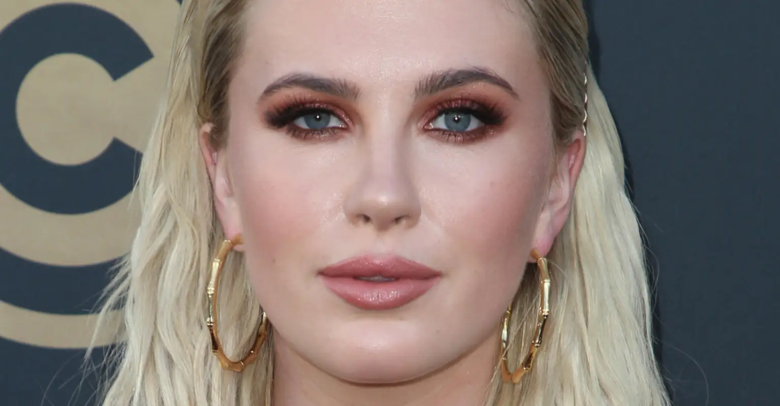 Ireland Baldwin reveals her blood-soaked face after suffering injury while 'babysitting for 45 minutes'