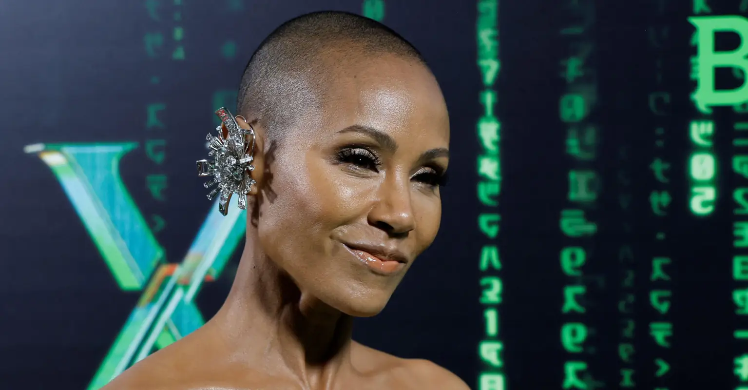 Jada Pinkett Smith gets candid about her struggle with alopecia: 'At this point I can only laugh'