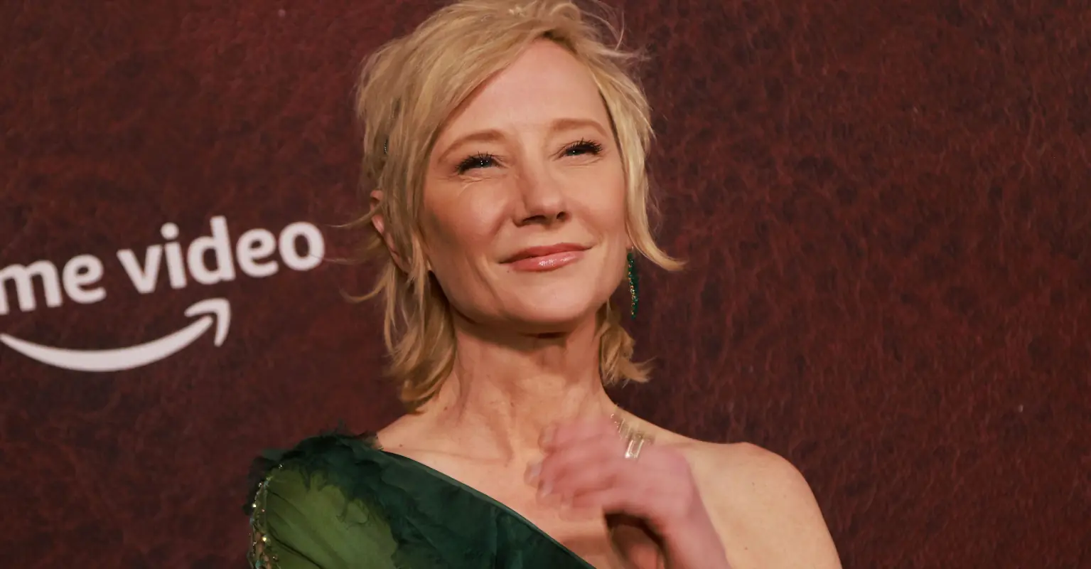 Anne Heche's rep says actress has 'severe' brain injury and is 'not expected to survive'