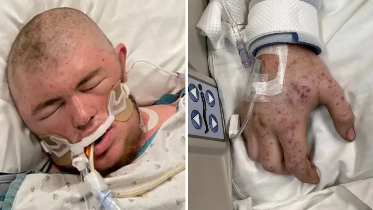 Man, 20, left fighting for his life after being stung 20,000 times by bees